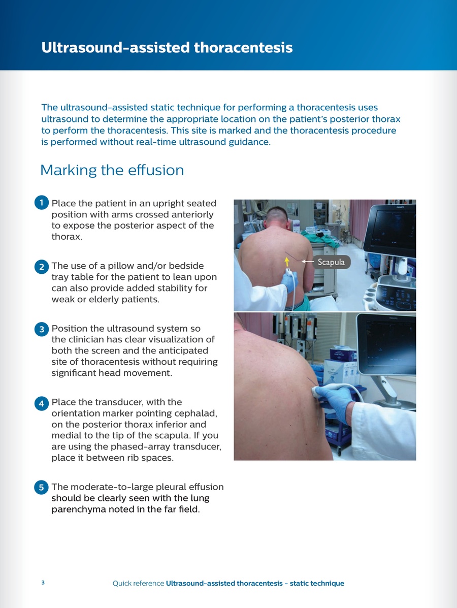 thoracentesis procedure steps